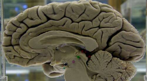 Brain health underpins how we live our lives