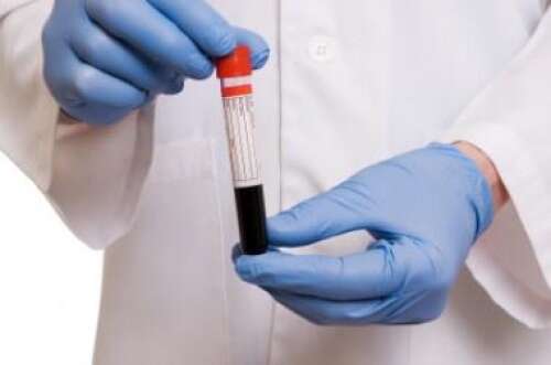 Hospital to phase out outside requests for overseas tests